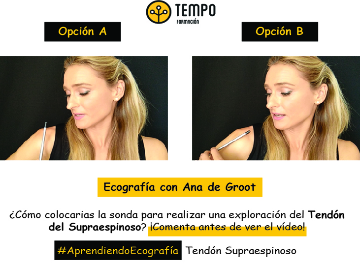 tendon-supraespinoso-ecografia-con-ana-de-groot